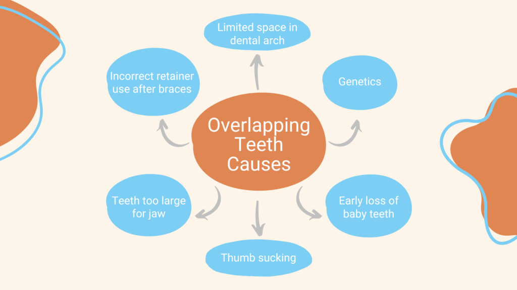 Overlapping (crowded) teeth causes